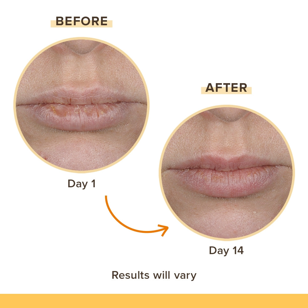 Burt's Bees Lip Balm Rescue 4 Pack